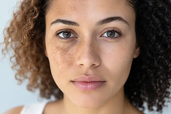Close-up portrait showing facial pigmentation and uneven skin tone